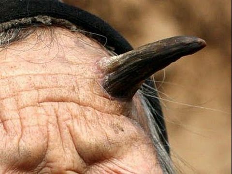 Когда на яичках кожа грубая Когда на яичках кожа грубая