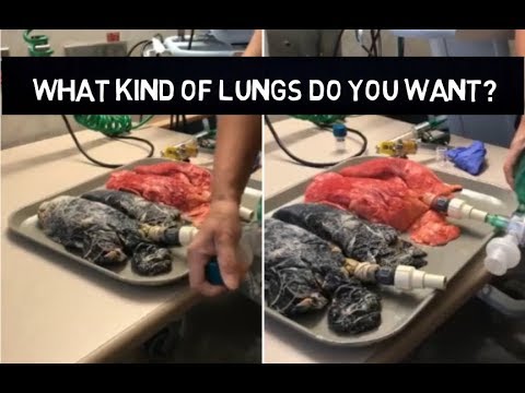 Nurse Shares Horrifying Video That May Finally Make You Quit Smoking