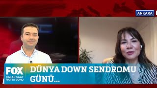 Dünya Down Sendromu Günü... 21 Mart 2021 İlker Karagöz Ile Çalar Saat Hafta Sonu