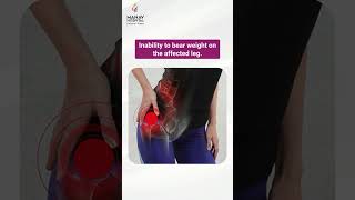 How To Know If You Have A Hip Fracture ?? Hip Fracture Signs And Symptoms Manav Hospital
