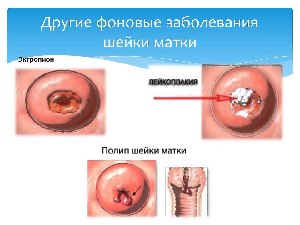 От гемипареза у детей лечение
