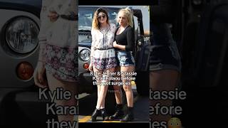 Kylie Jenner & Stassie before they got surgery😳#kyliejenner #celebrity #goviral 