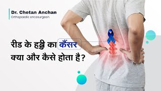 रड क हडड क कसर कय और कस हत ह? Spinal Cancer In Hindi Dr Chetan Anchan, Mumbai