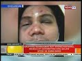 Grupong nambugbog kay Vhong Navarro, mabilis at sistematiko ang galaw ayon sa isang saksi