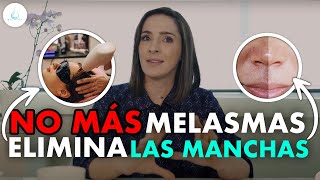 Hiperpigmentación o manchas en la piel ¿Cómo tratarlas?, Dra. Pilar Ochoa - Dermatología