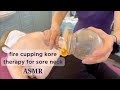 Fire Cupping Kore Therapy for Sore Neck and Shoulder 🔥