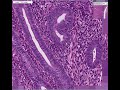 endometrium