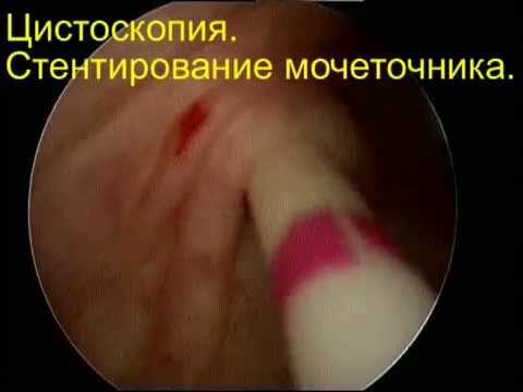 Как у беременных со стулом 8