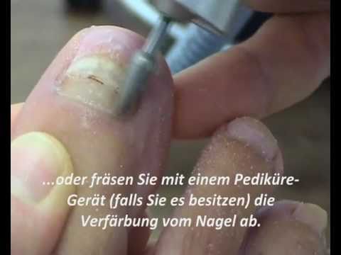 erotische thai massage stuttgart das erste mal geschlechtsverkehr erotische thai massage stuttgart das erste mal geschlechtsverkehr