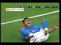 la peor lesion del futbol-pierna partida