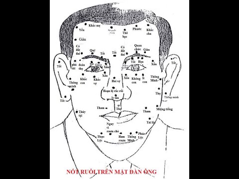 NỐT RUỒI TRÊN MẶT ĐÀN ÔNG