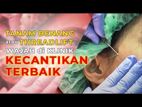 TANAM BENANG ATAU THREAD LIFT WAJAH DI KLINIK KECANTIKAN TERBAIK #ASKTHECLINIC - YouTube