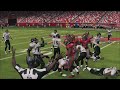 Revis