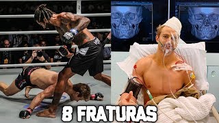 BRASILEIRO CAUSA 8 FRATURAS COM APENAS 1 SOCO, MCGREGOR PROVOCA E É RESPONDIDO POR RAFAEL DOS ANJOS!