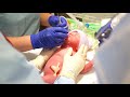 Video BIRTH VIDEO OF BABY TWINS TAYTUM AND OAKLEY (EMOTIONAL)
