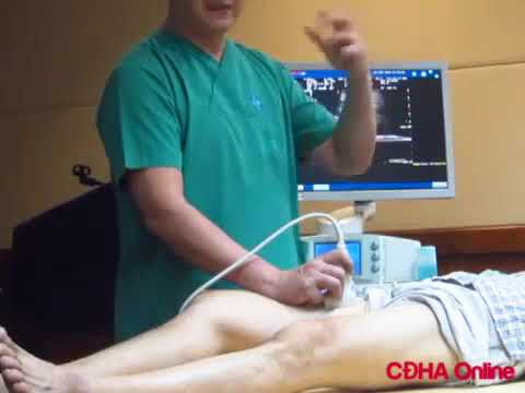Thực hành siêu âm Doppler mạch máu chi dưới Bs. Nguyễn Quang Thái Dương