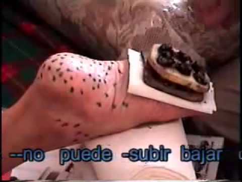 JISASCRAI NEW TERAPY - DR.WAY - PUNZADA EN LOS PIES JISASCRAI NEW TERAPY - DR.WAY - PUNZADA EN LOS PIES