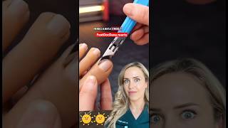 Doctor Reacts To Toenail Torture Device
