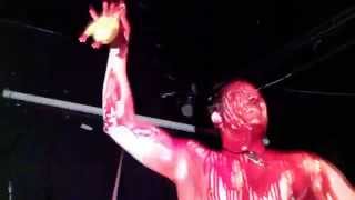 Watch Haemorrhage Traumaggedon video