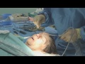 Major surgery and face lift for Jackie - 10 Years Younger