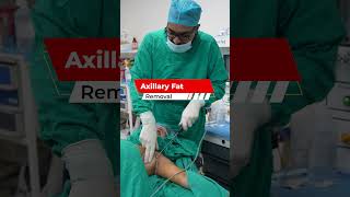 Axillary Fat Removal Axillary Fat Axillary Fat Cost Dezire Clinic