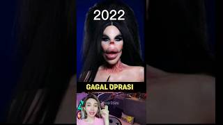 Gagal Oprasi Plastik