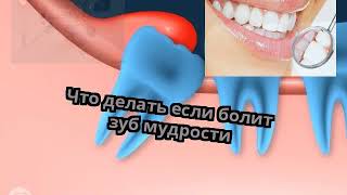 Почему когда болит зуб все болят рядом Почему когда болит зуб все болят рядом