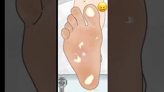 how to clean your feet 😱 पैरों को साफ कैसे करें 🤔 #shorts #asmr #ytshorts