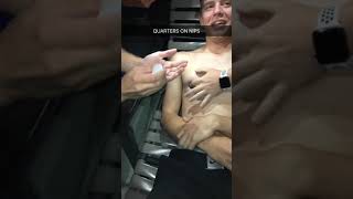Supergluing Quarters On Nips