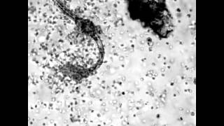 Microramziology Eosinophils Attacking A Parasite