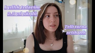 Diş Teli Sürecim Memnun Kaldım Mı?