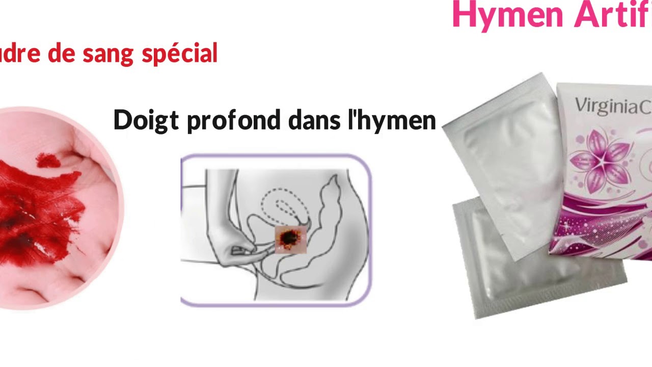 What dose a hymen look like