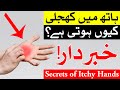 Hath Me Khujli Hone Se Kya Hota Hai | hath me khujli ho to kya kare | Mehrban Ali | Itchy hands