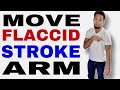 How to Move a Flaccid or Weak Stroke Arm