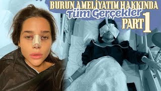 Burun Ameli̇yatim Hakkinda Tüm Gerçekler - Part 1