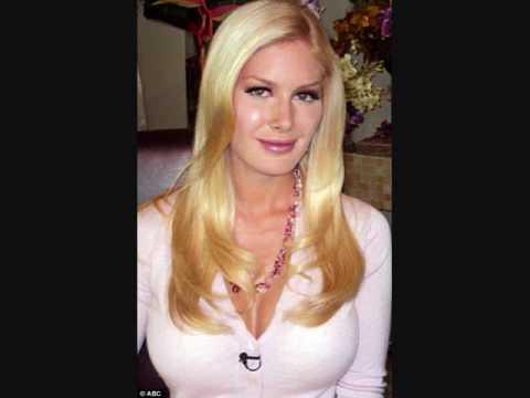 heidi montag after surgery people. heidi montag before and after surgery actual video