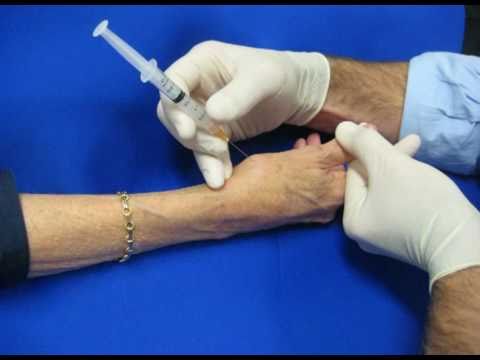 Steroid shot in wrist joint