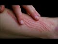 self cutting