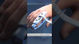 Eğer Parmağınız Kırılırsa...