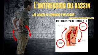 Lantéversion Du Bin Et Les Inconforts Dans Le Dos Comment Men Débarré.