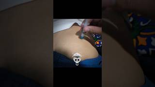 Sciatic Nerve Be Careful