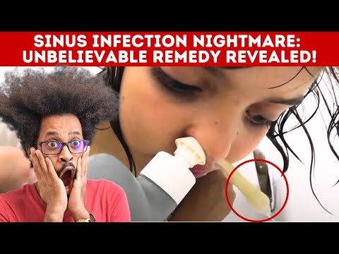 Scary Sinus Infection - Must watch