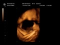 Lori's Ultrasound 2/9/2010