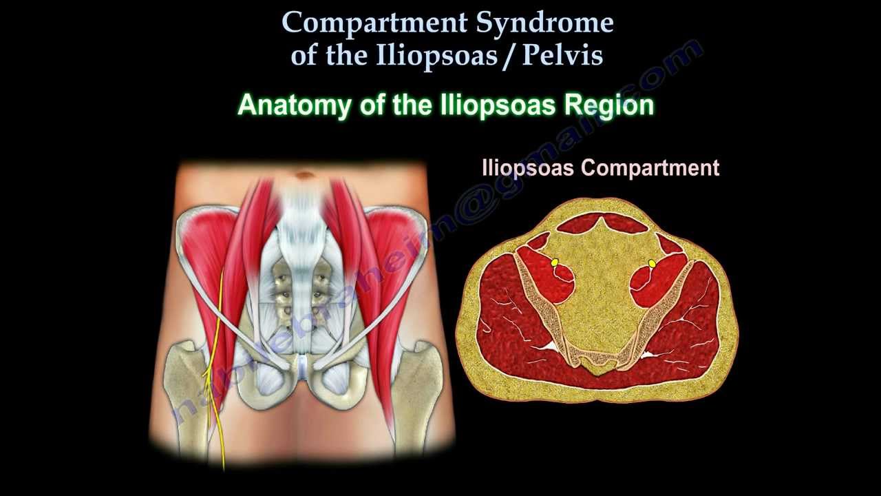 Iliopsoas, Pelvic Compartment Syndrome- Everything You Need To Know- Dr