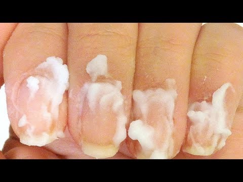 Rub Some Baking Soda On Your Nails And Watch What Happens