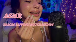Asmr Delicate Teeth And Braces Tapping & Soft Mouth Sounds For Sleep