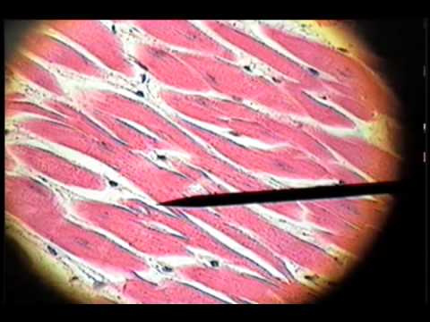 Slide 35 - Cardiac Muscle - YouTube