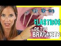 🖍📒ELASTICOS INTERMAXILARES para asentar MORDIDA - Para que sirven las GOMAS de los BRACKETS