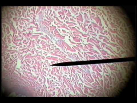 Dense Regular Connective Tissue. 00:11. Watch on YouTube: Slide 21 Dense 