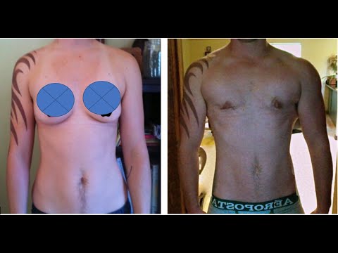 Results from propionate